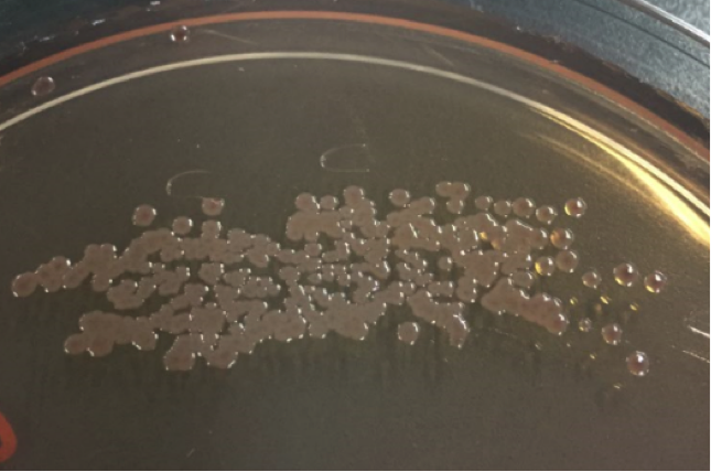 O-157の菌コロニー所見