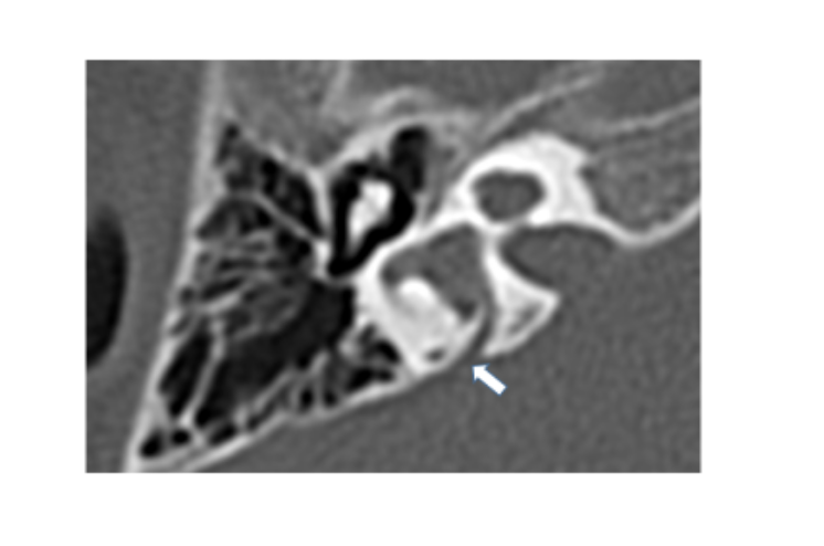 ペンドレット　写真