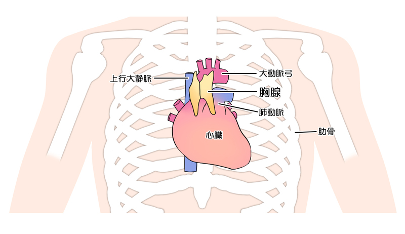 ADA欠損症とは？ 症状と予後 メディカルノート