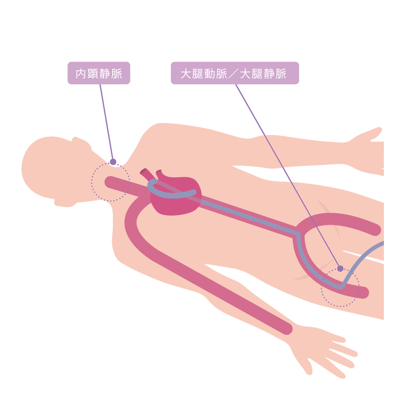 心房細動の治療法カテーテルアブレーションとは メディカルノート