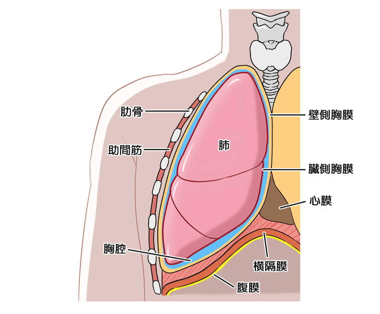 良性石綿胸水とは アスベスト 石綿 によって胸水がたまる病気 メディカルノート