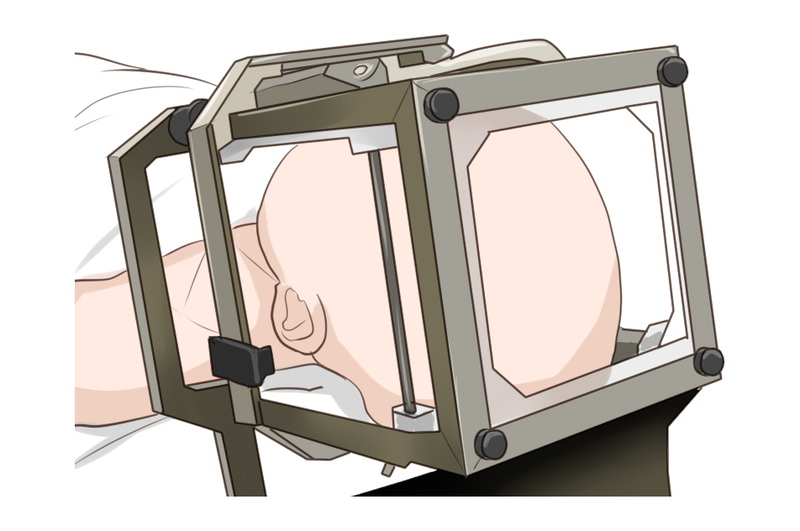 DBS（脳深部刺激療法）手術