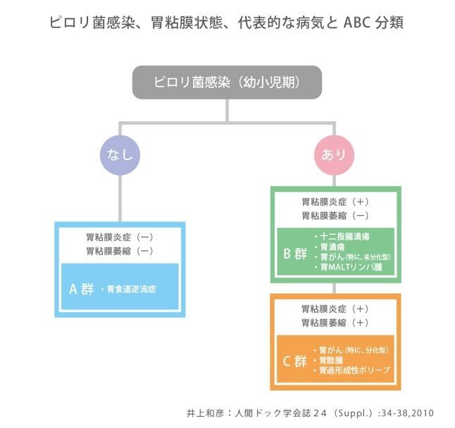 ABC分類