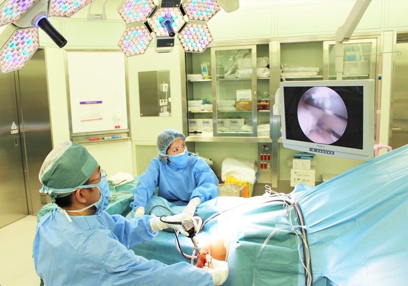 関節鏡視下手術の様子