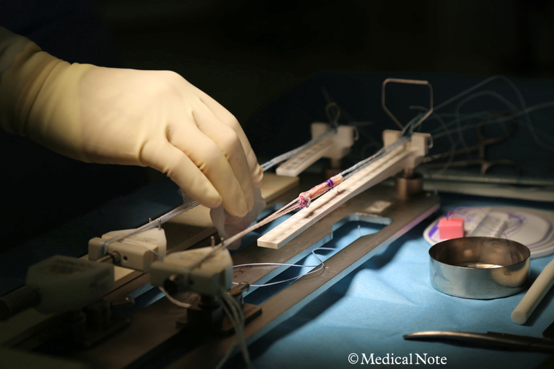 作成した移植腱