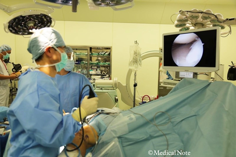 術者は関節鏡の映像をみながら手術を行う