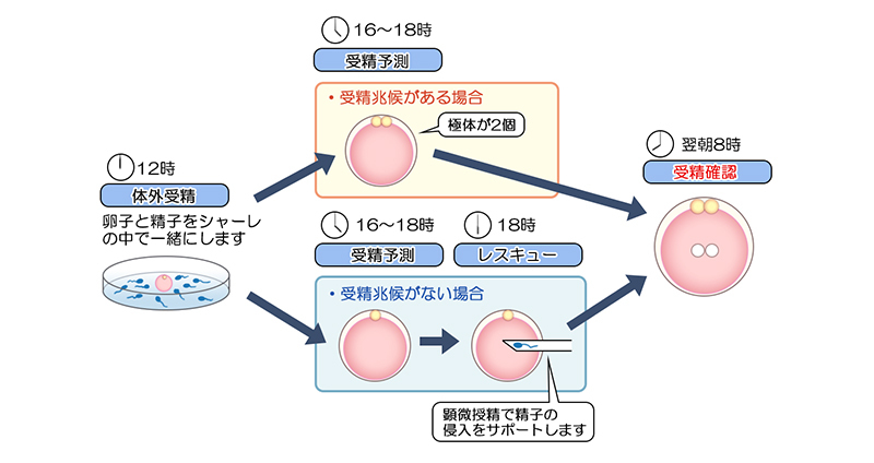 レスキュー・イクシー（ICSI）