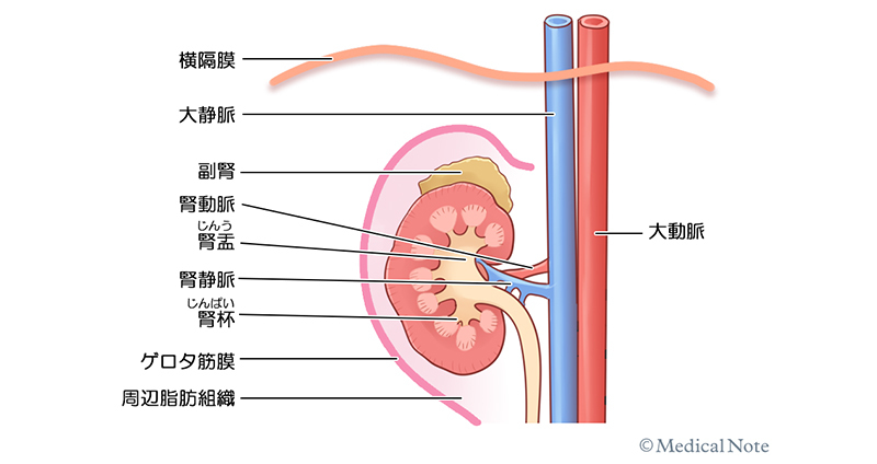 腎細胞がんのステージ（病期）について