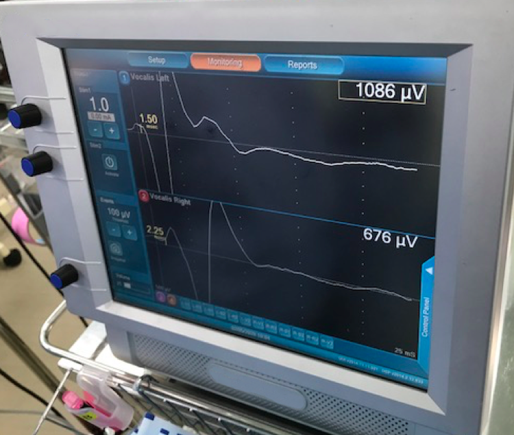 神経モニタリングシステムのモニター