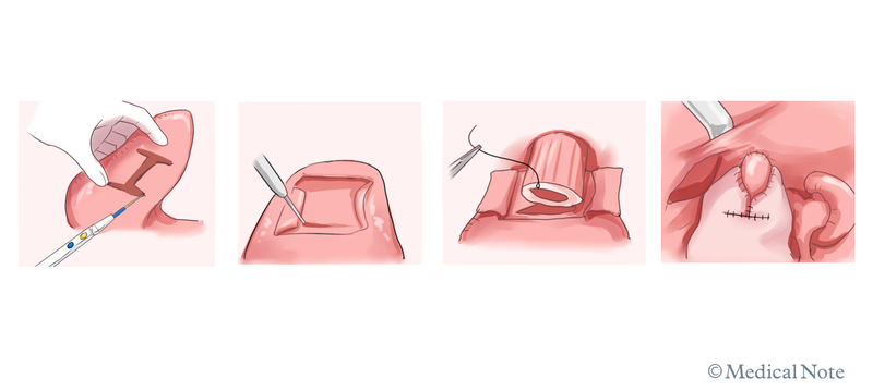 上川法の手技イメージ