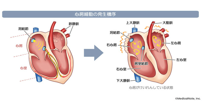 心房細動の発生機序