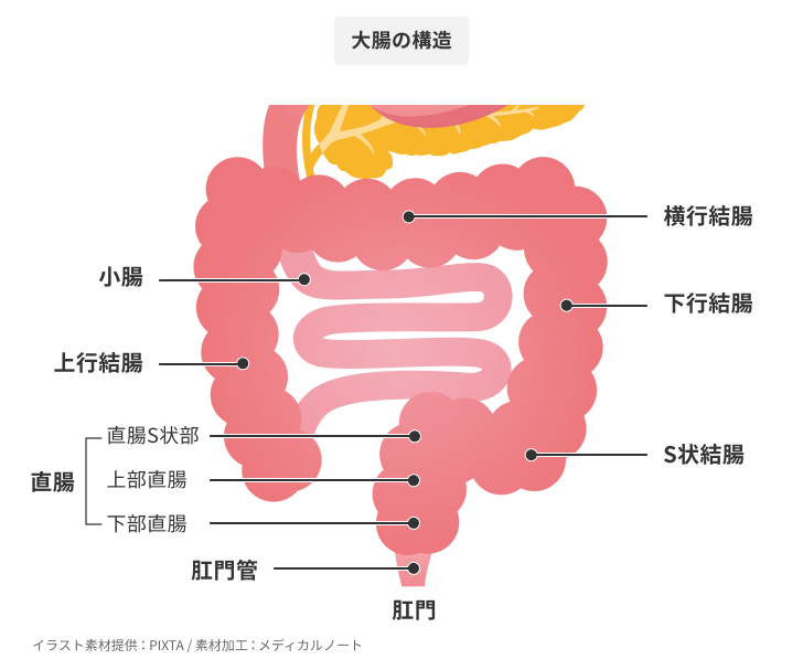 日本において罹患数の多い 大腸がん その原因 症状とは メディカルノート