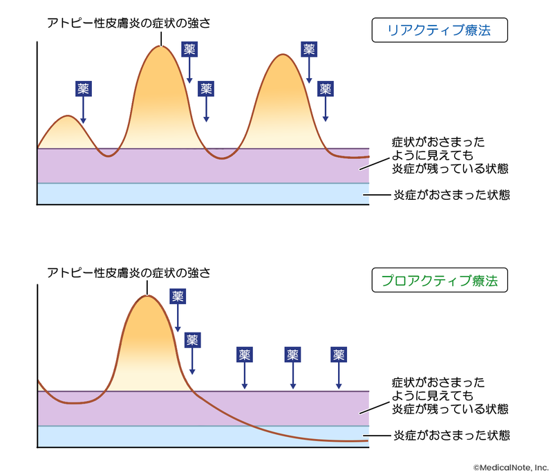 リアクティブ、プロアクティブ療法