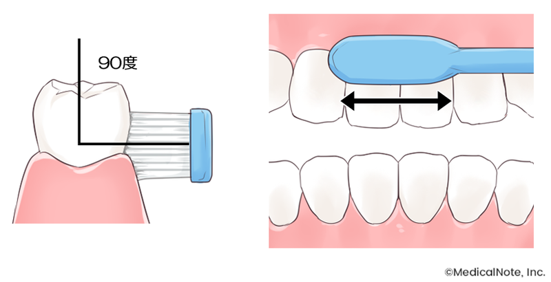 歯に対して直角に歯ブラシを当て、往復する。