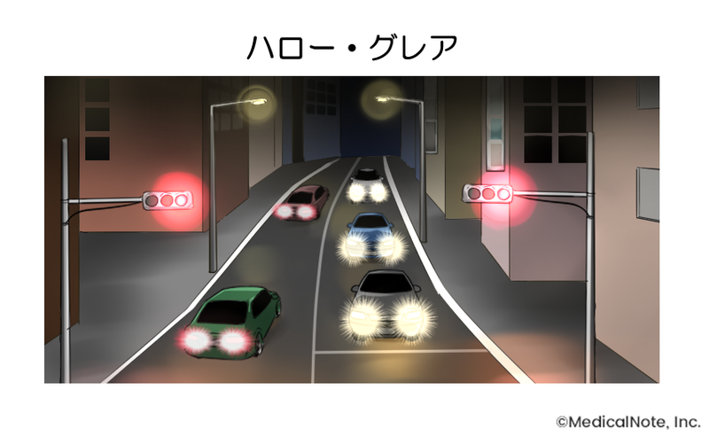 ハロー：光がリング状ににじんで見える  グレア：光がまぶしく見える