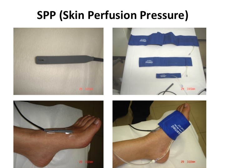 SPPの測定