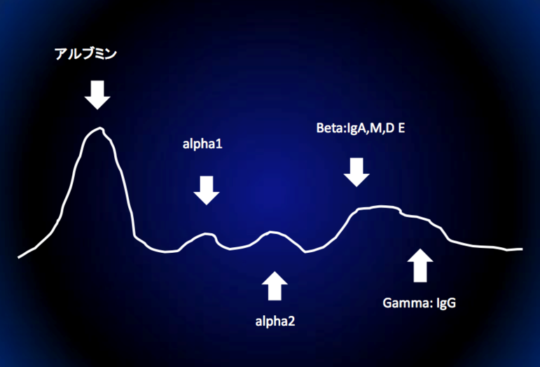 これが正常所見です。右のほうはなだらかになっています。