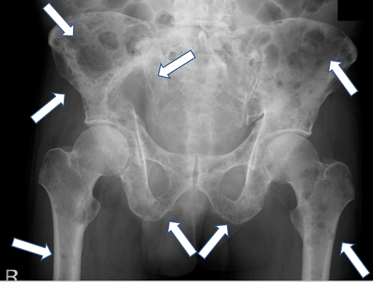 勃起不全redditなしでバイアグラを服用