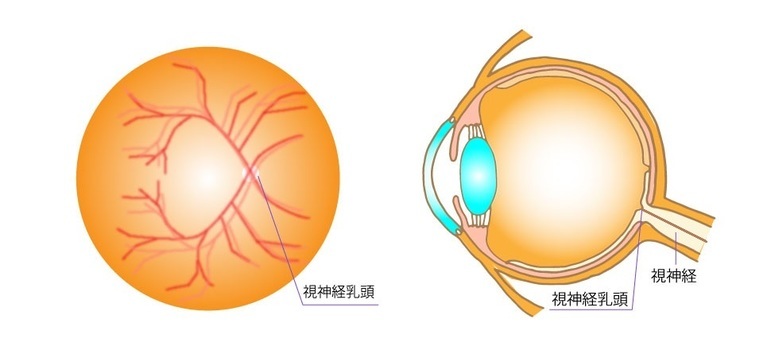視神経乳頭
