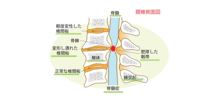 頚椎側面図