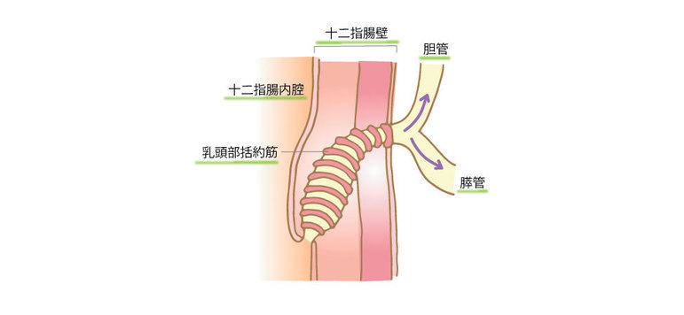 先天性膵胆管合流異常