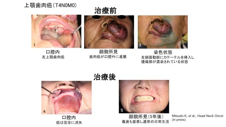 症例②