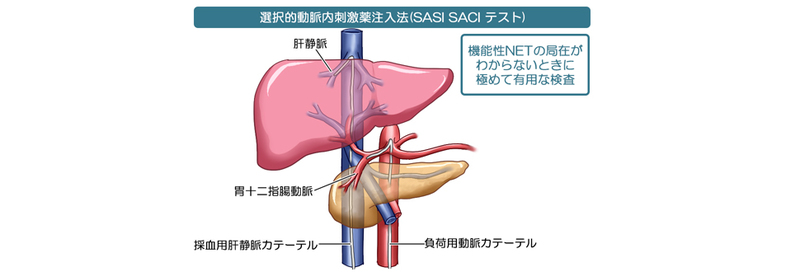 SASI testの概要