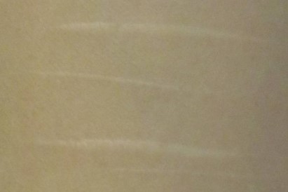 リストカット後の瘢痕　症例画像提供：貴志和生先生