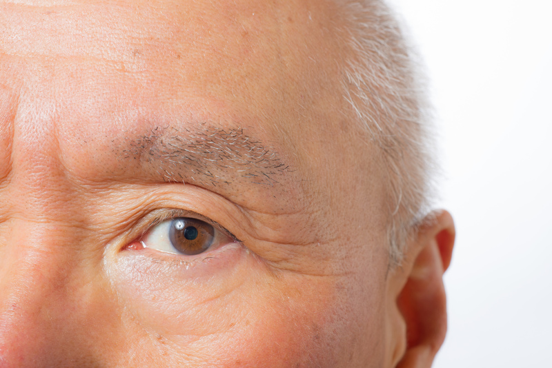 高齢者の目