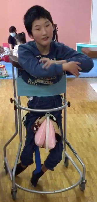 治療後　歩ける少女