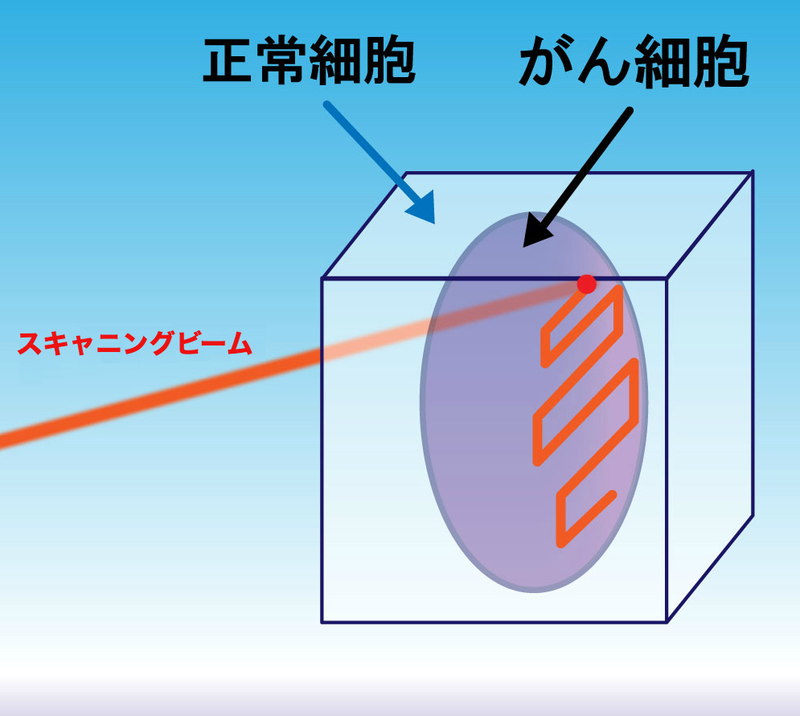 スポットスキャニング照射