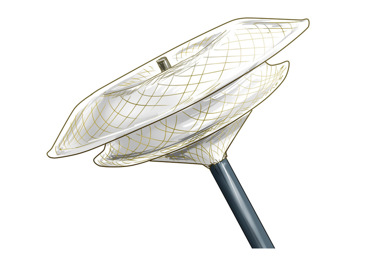 インターベンション治療に用いる手術器具