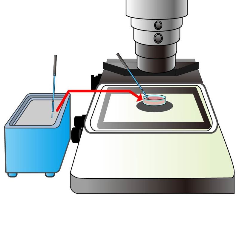 凍結卵子の融解