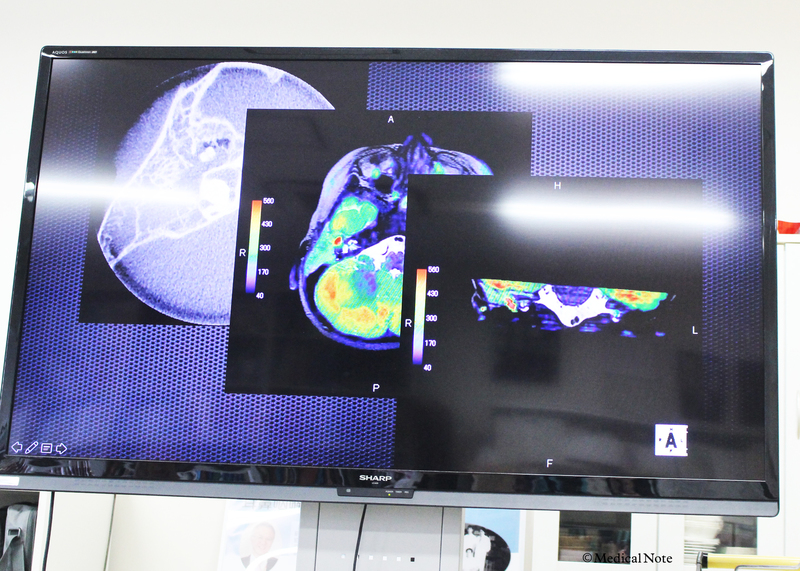 MRIを利用した病変部位の写真