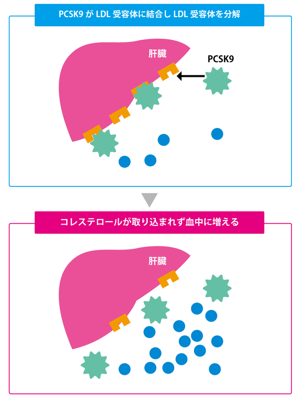 ＰＣＳＫ９阻害薬