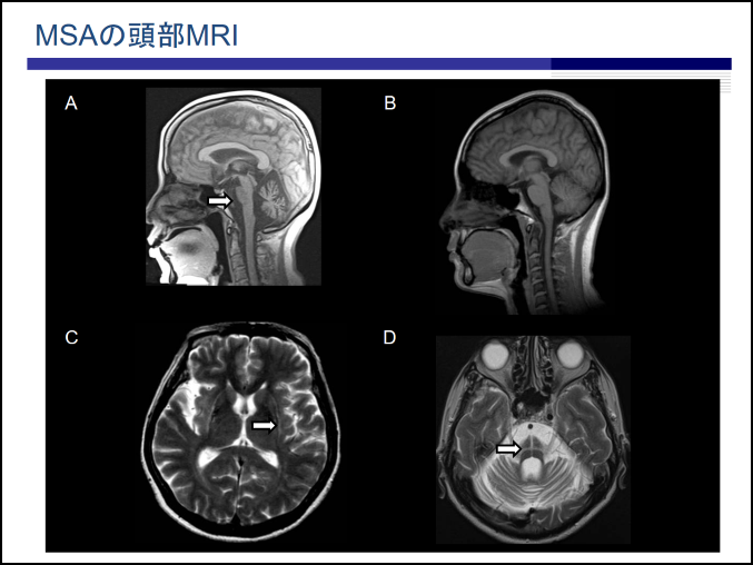 MRI　提供画像