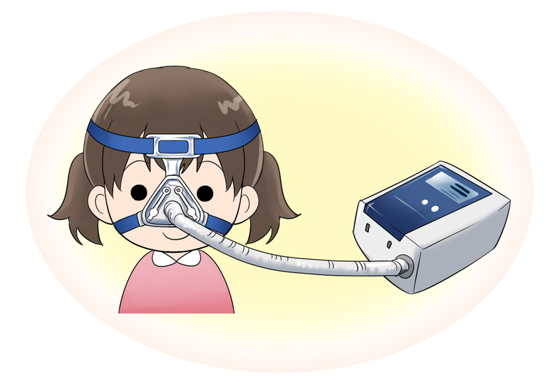 鼻マスク人交換気法