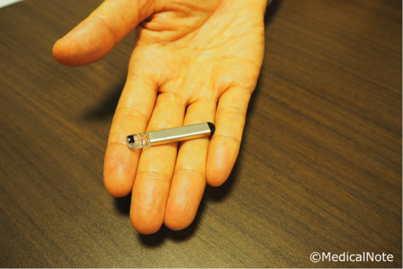 植込み型心電図ループレコーダー