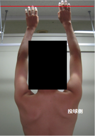 肩甲骨で見る姿勢の状態