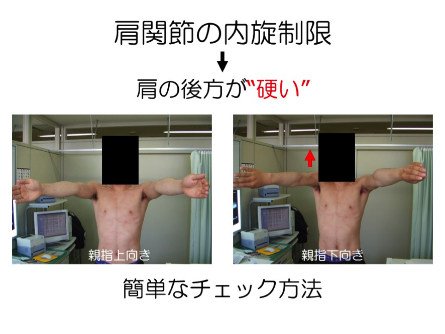 野球肘のための肩関節のチェック