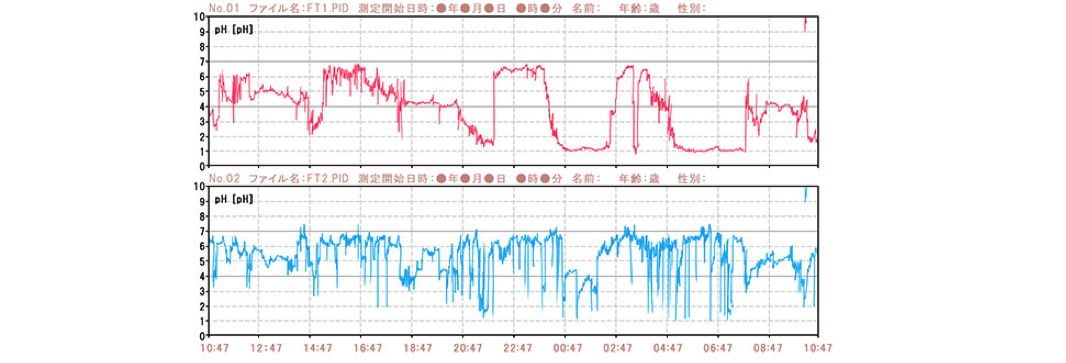 pHモニタリング検査のグラフイメージ