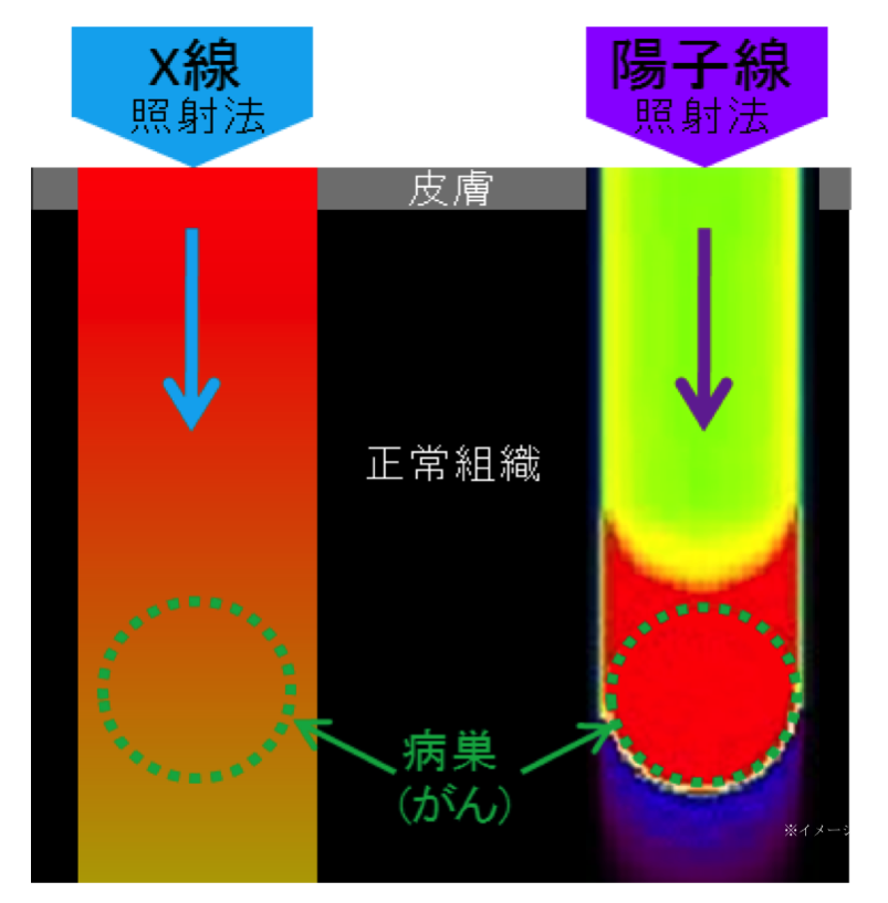 重粒子線とx線照射の比較