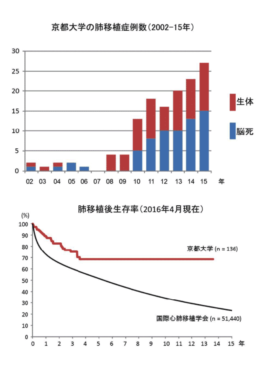 京都大学の肺移植症例数