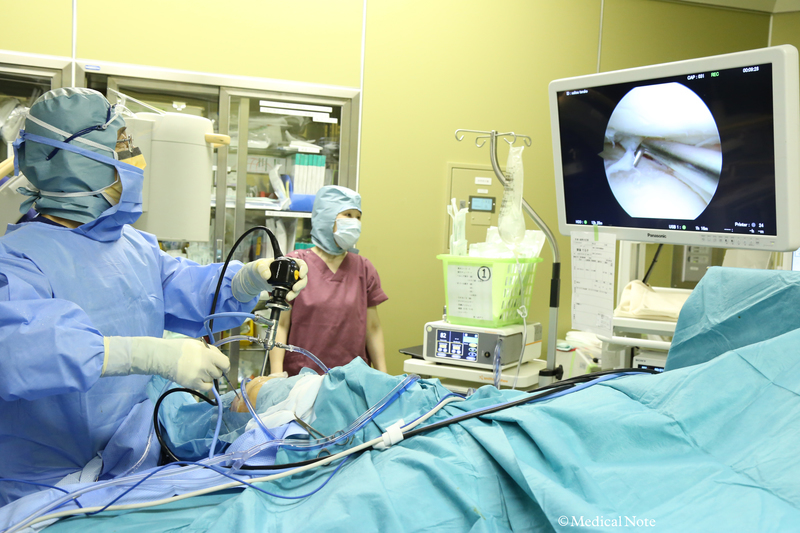 関節鏡によって膝の内部をきれいにする