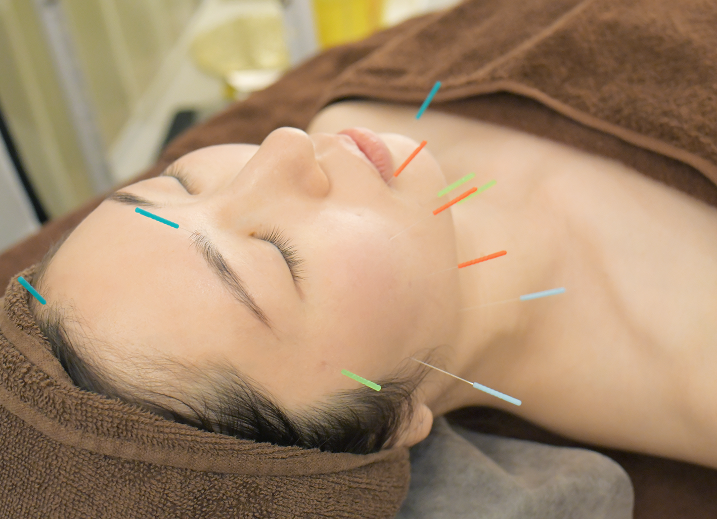 美容鍼灸（90分）