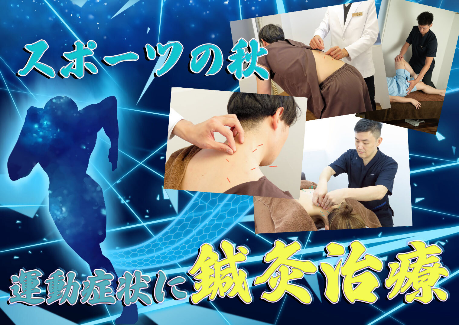 【今月のオススメ】スポーツの秋！運動症状に鍼灸を！スポーツケアコース！