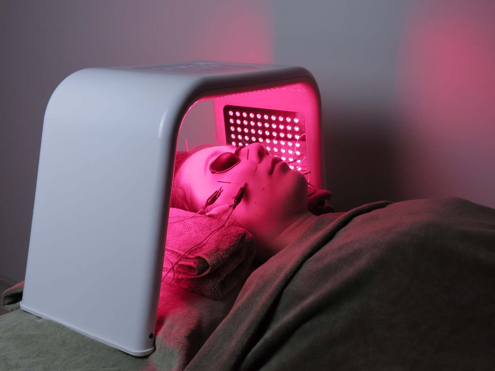 【初回】毎月8名限定｜【食いしばりによるエラ張り・たるみに】小顔美容鍼+LED