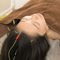 睡眠鍼（60分）