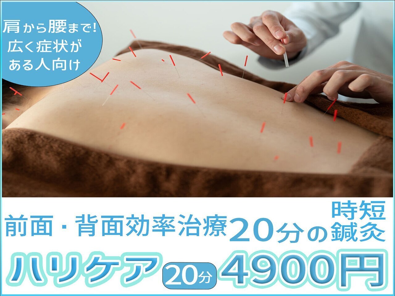 ハリケア20分 スピード鍼灸