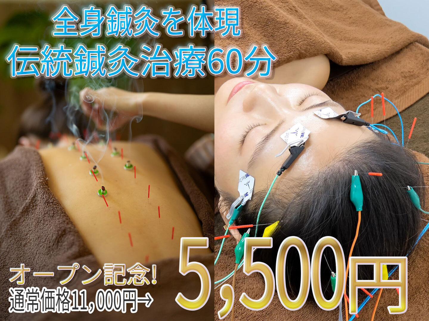 【オープン記念3/15~21限定】伝統鍼灸治療60分 5500円